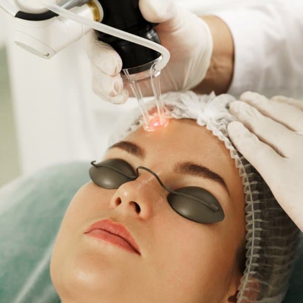 Laser Skin Resurfacing
