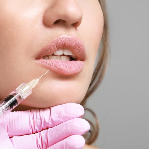Lip Fillers