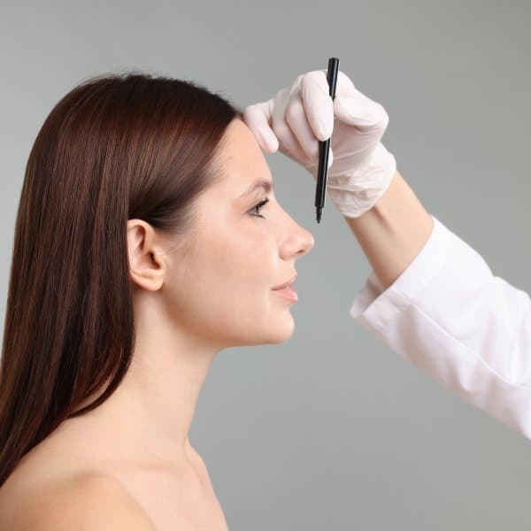 Rhinoplasty