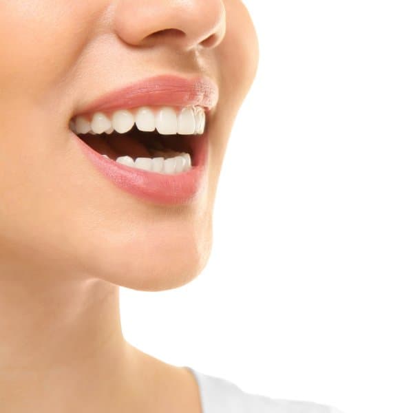 Smile Design